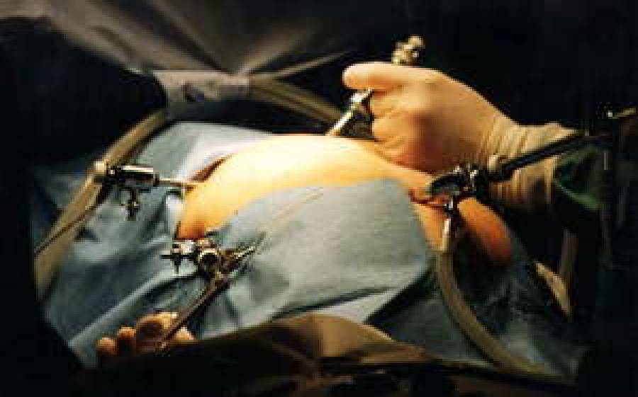 Цена врачебной ошибки