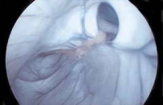  Головной мозг изнутри.