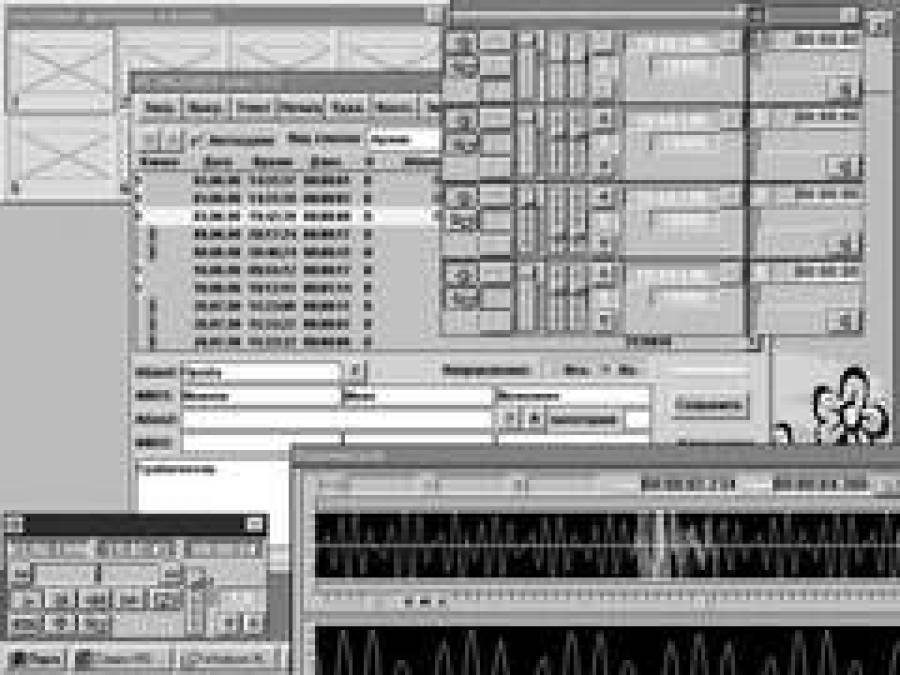  Так работает &quot;Незабудка&quot;.